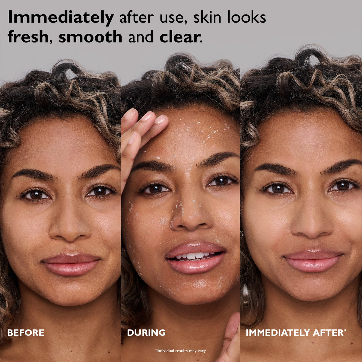 FIRMx Peeling Gel|3.4 fl oz