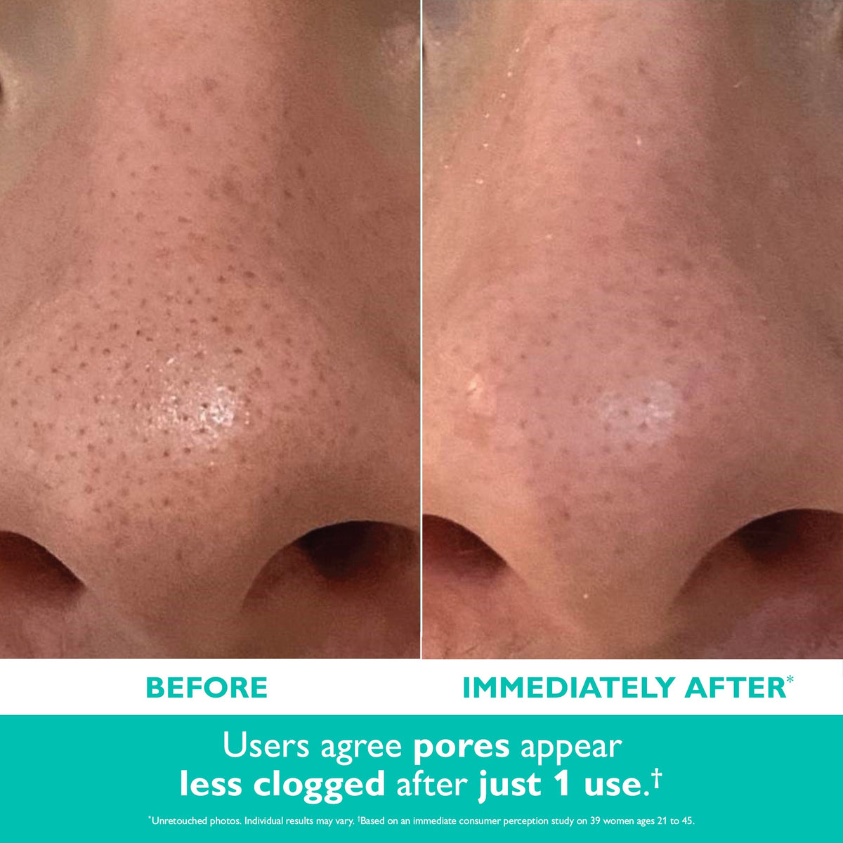 Even Smoother™ Microdermabrasion Exfoliating Pore Purifier|50 ml / 1.7 fl oz