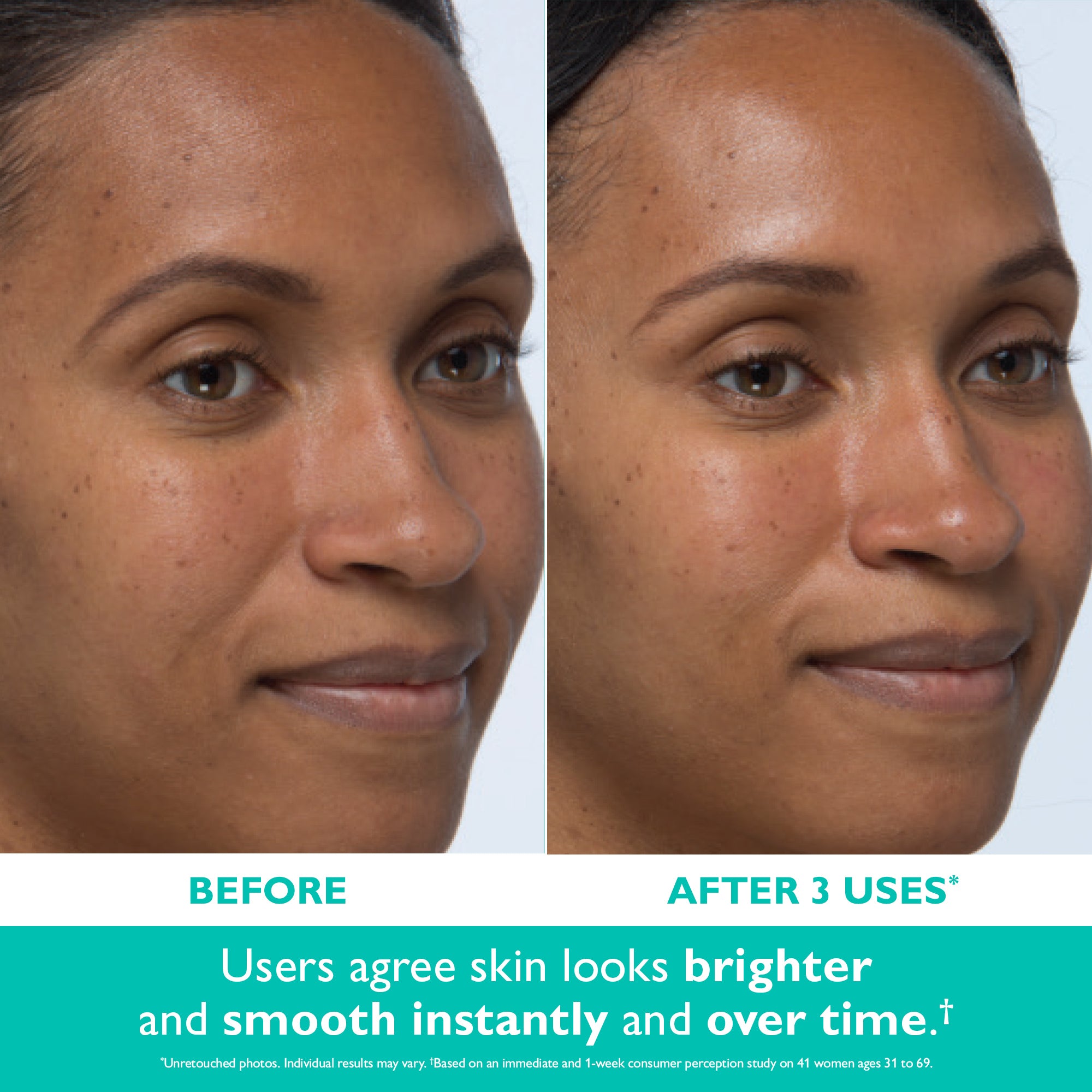 Even Smoother™ Instant Reveal Facial Peel|8 cotton swabs Secondary image