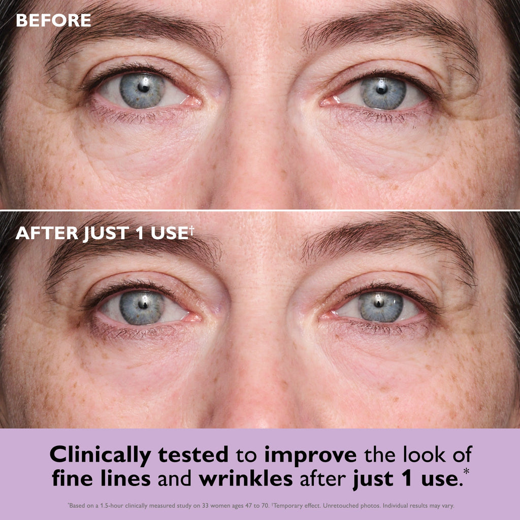 Instant FIRMx® Collagen Tightening Eye Patches