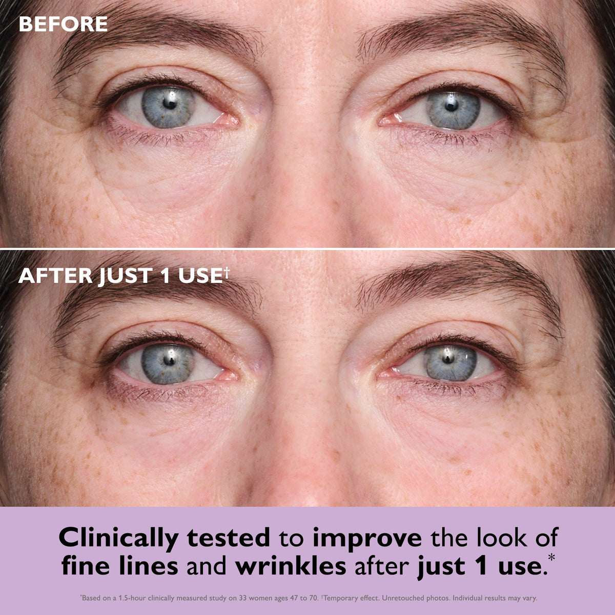 Instant FIRMx® Collagen Tightening Eye Patches