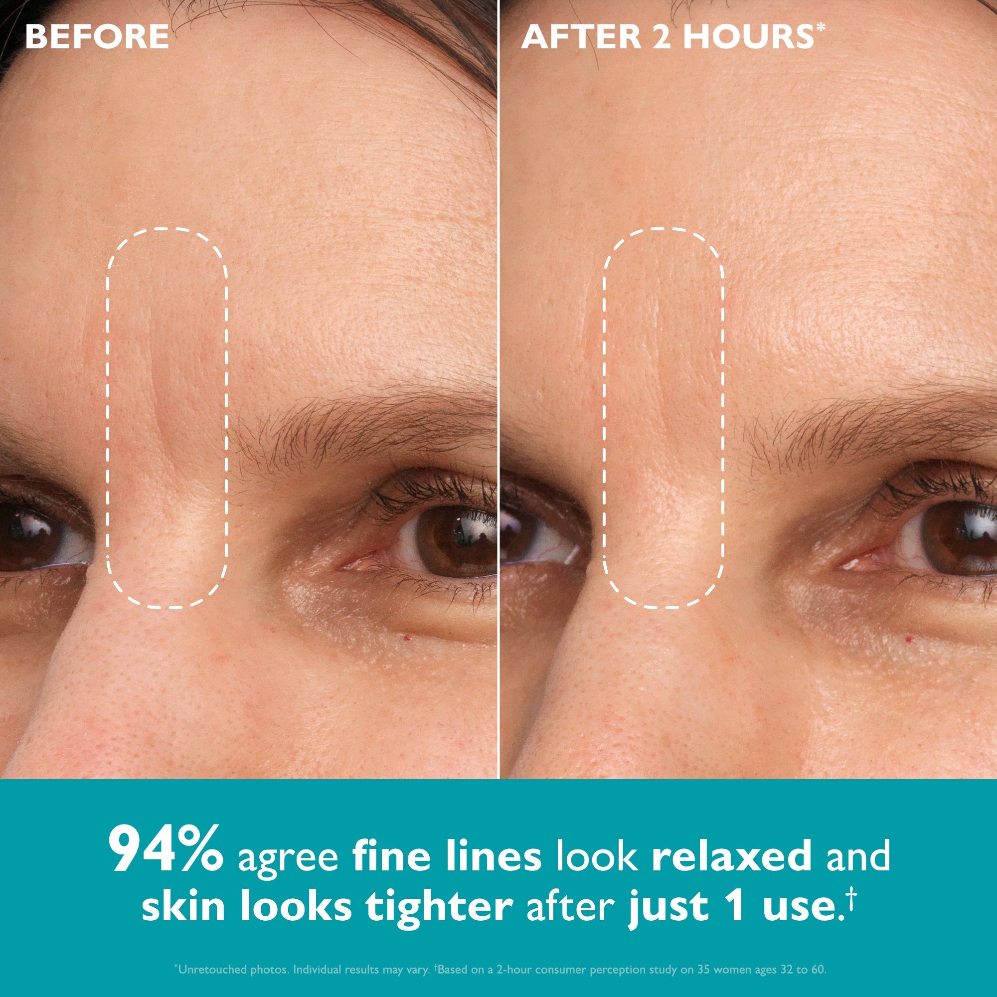 Peptide Skinjection Peptide Infused Face + Eye Tape Secondary image