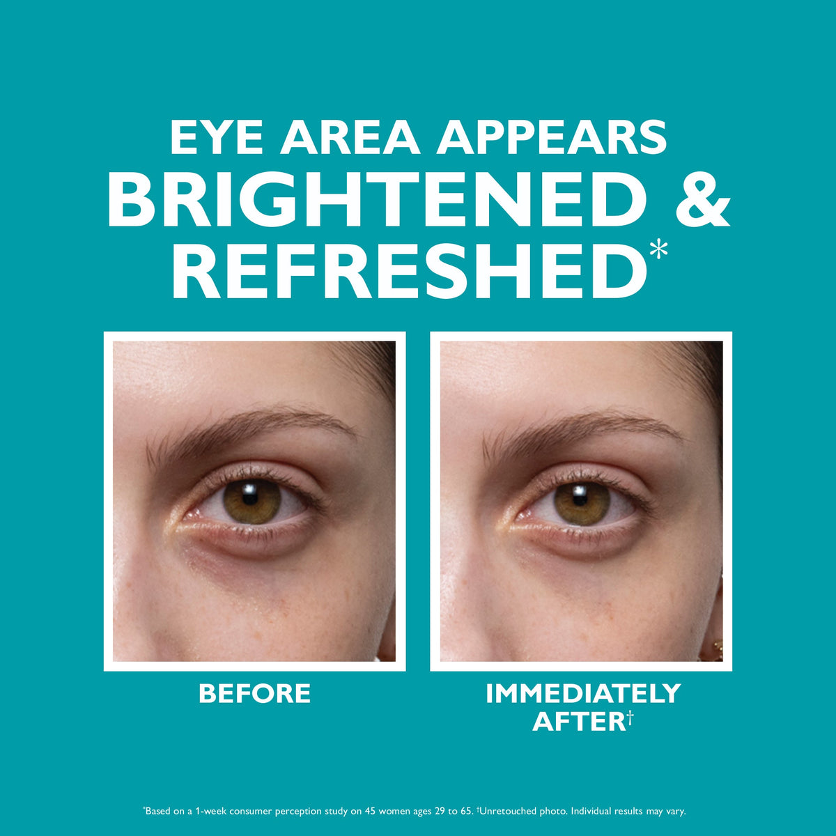 Peptide Skinjection™ Fill + Fix Under-Eye Cream