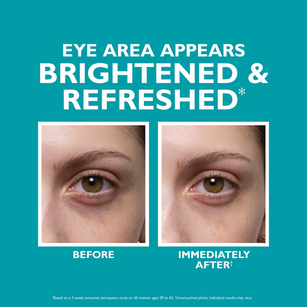 Peptide Skinjection™ Fill + Fix Under-Eye Cream