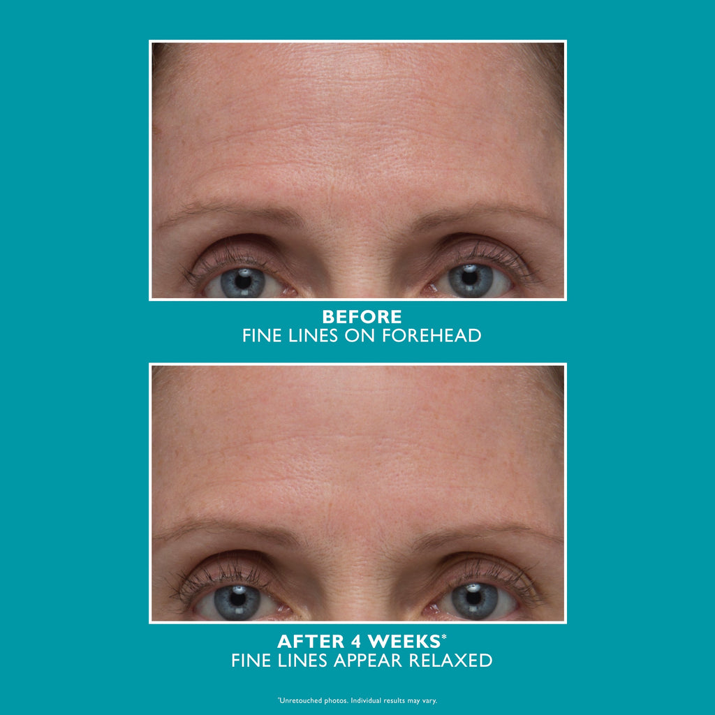 Peptide Skinjection Amplified Wrinkle-Fix Serum|30 ml / 1 fl oz