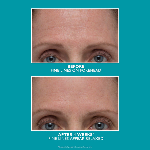 Peptide Skinjection Amplified Wrinkle-Fix Serum|30 ml / 1 fl oz