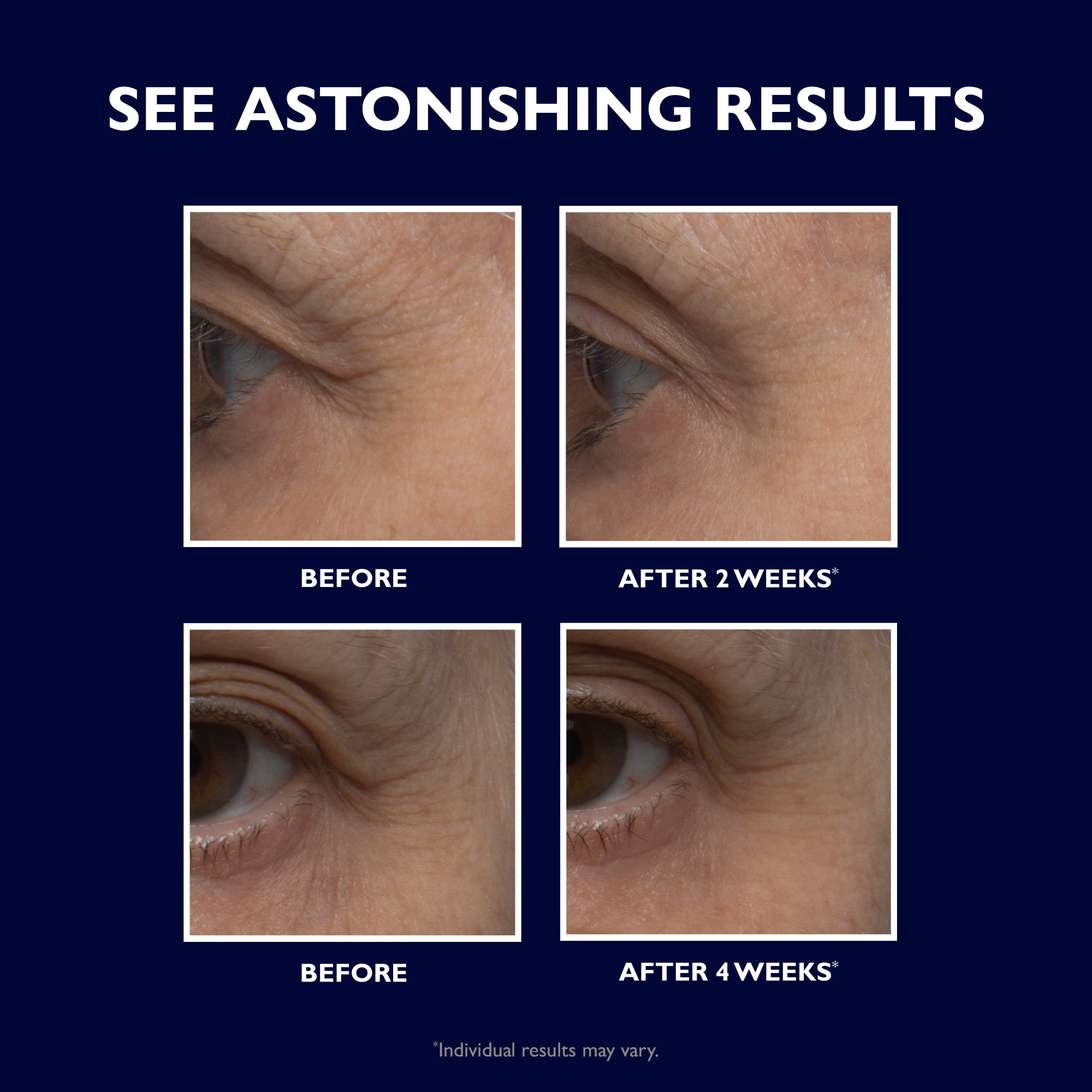 Retinol Fusion PM Eye Cream - Super Size|30 ml / 1.0 fl oz Secondary image