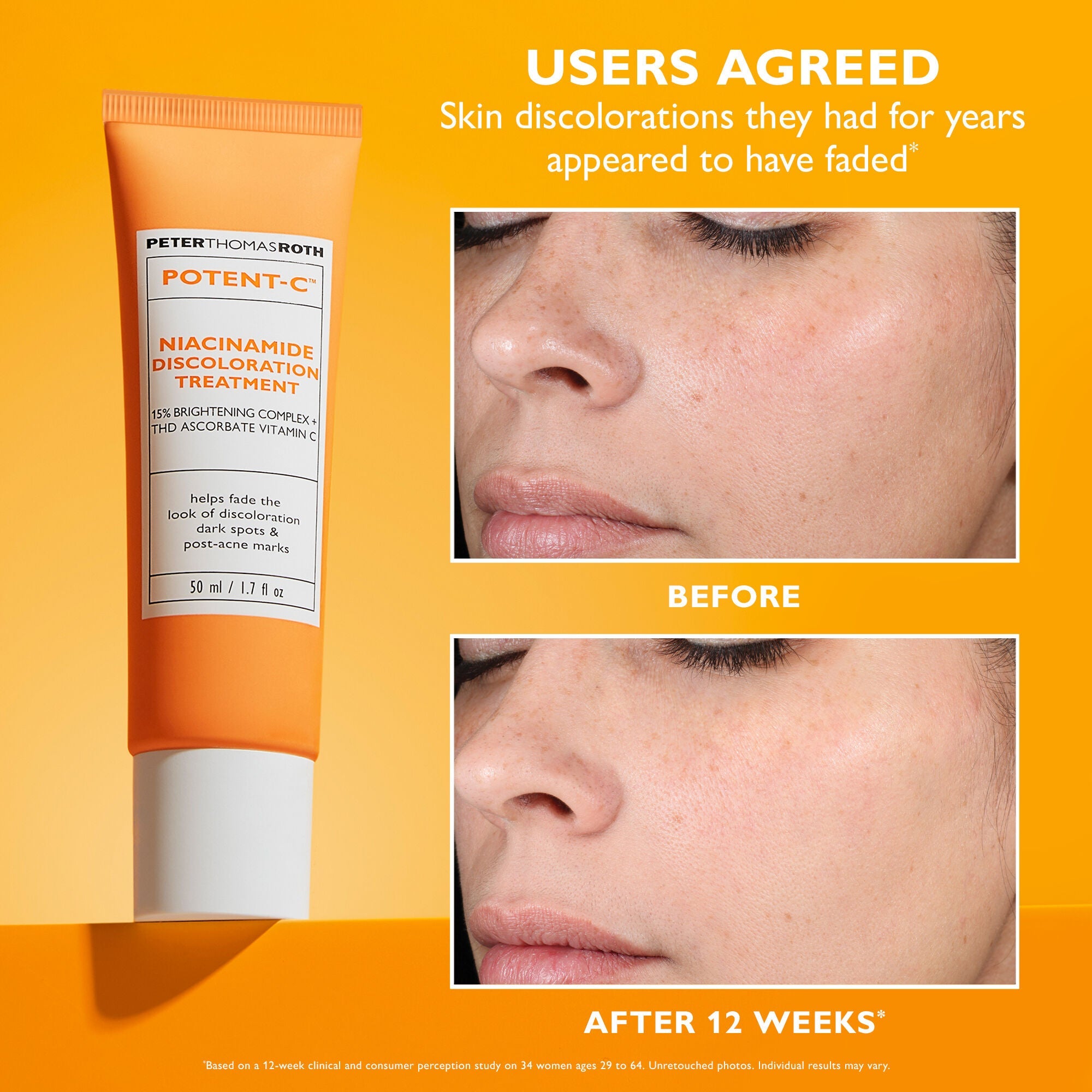 Potent-C Niacinamide Discoloration Treatment | 50 ml/1.7 fl oz Secondary image