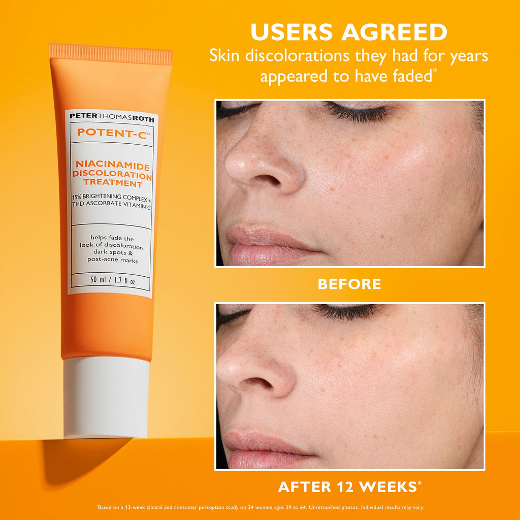 Potent-C Niacinamide Discoloration Treatment | 50 ml/1.7 fl oz