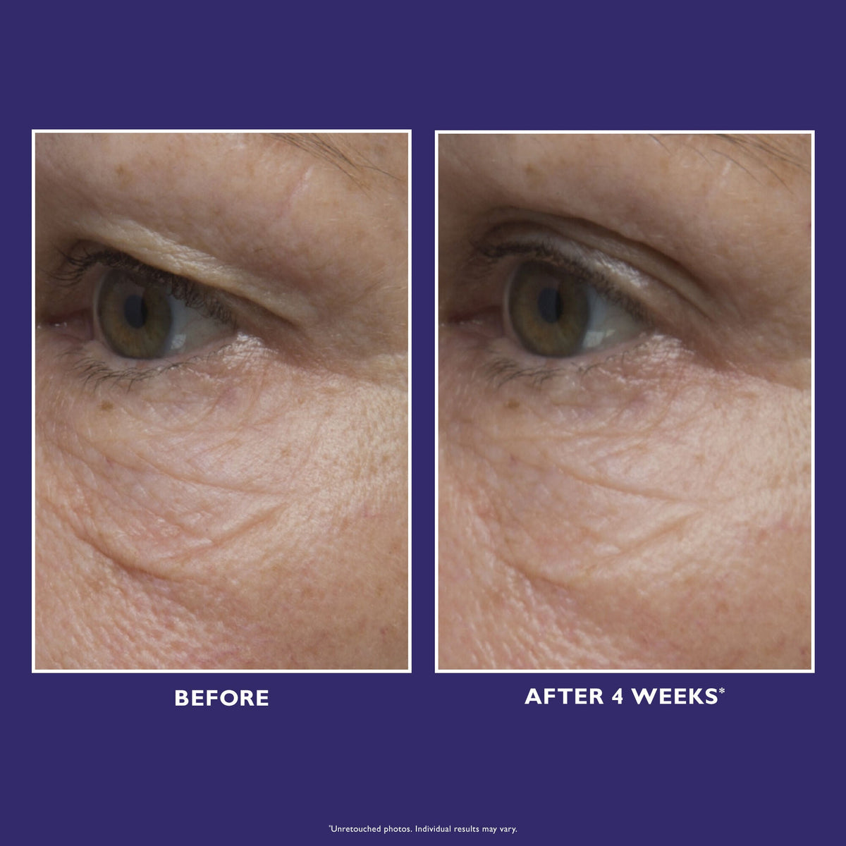Ultimate Solution 5 Multitasking Eye Cream|15 ml / 0.5 fl oz