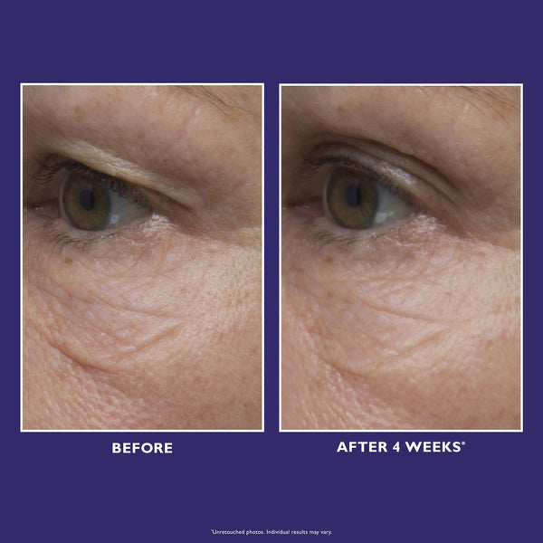 Ultimate Solution 5 Multitasking Eye Cream|15 ml / 0.5 fl oz