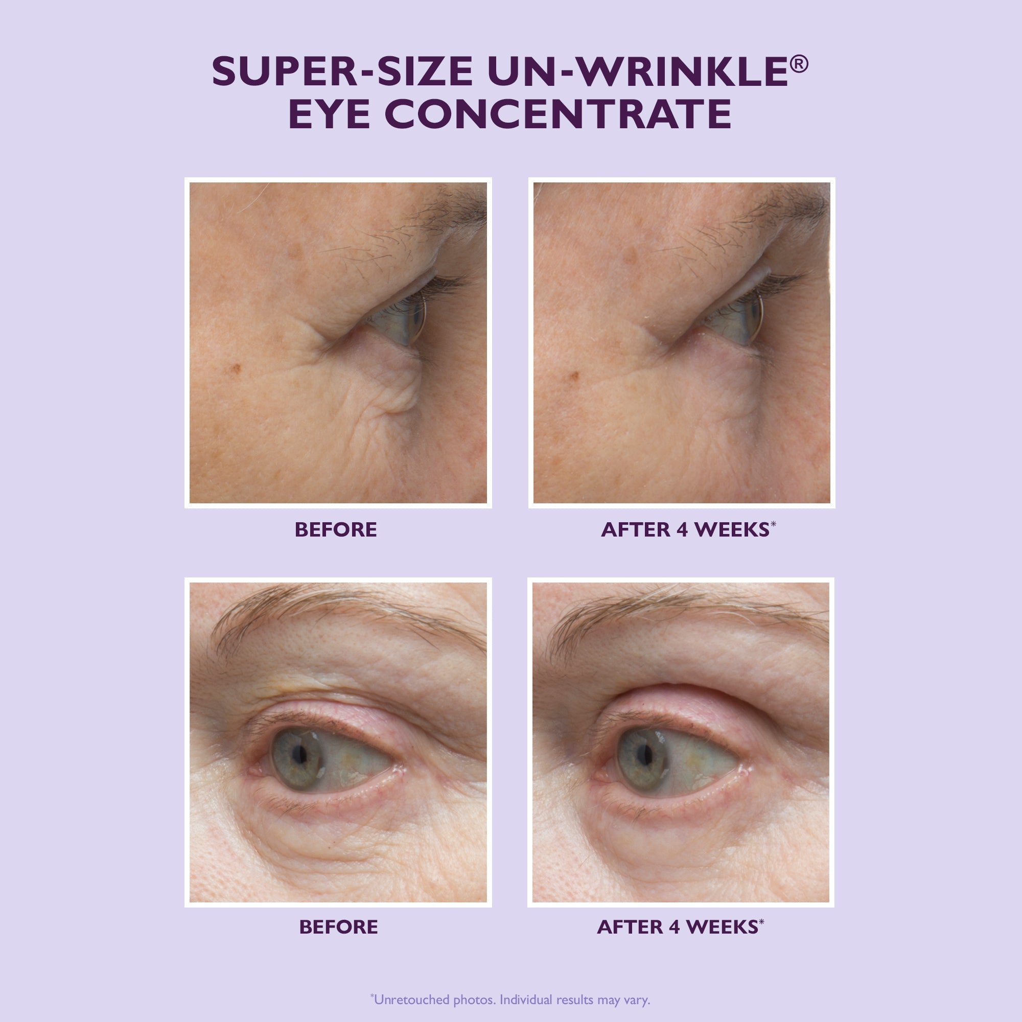 Super-Size Un-Wrinkle Eye Concentrate|30 ml / 1 oz Secondary image