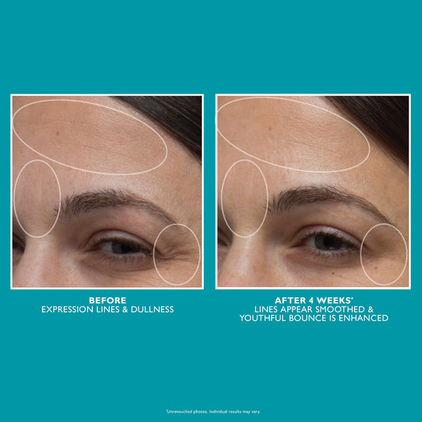 Peptide Skinjection Moisture Infusion Cream | 50ml