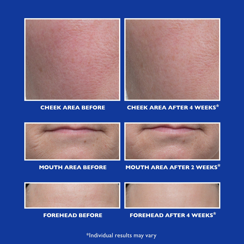 Retinol Fusion PM Night Serum|1.0 fl oz