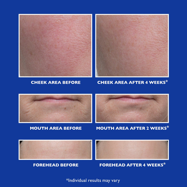 Retinol Fusion PM Night Serum|1.0 fl oz