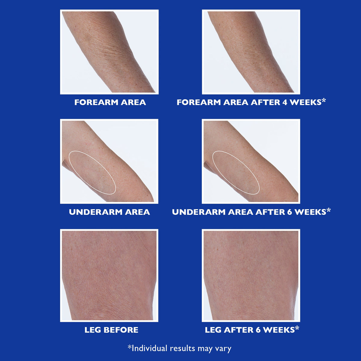 Retinol Fusion PM Night Serum|1.0 fl oz